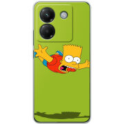 Чохол BoxFace Poco M7 Pro 5G 
