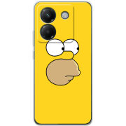 Чохол BoxFace Poco M7 Pro 5G 