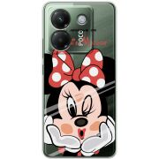 Прозорий чохол BoxFace Poco M7 Pro 5G Lady M