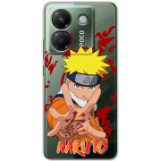 Прозорий чохол BoxFace Poco M7 Pro 5G Naruto