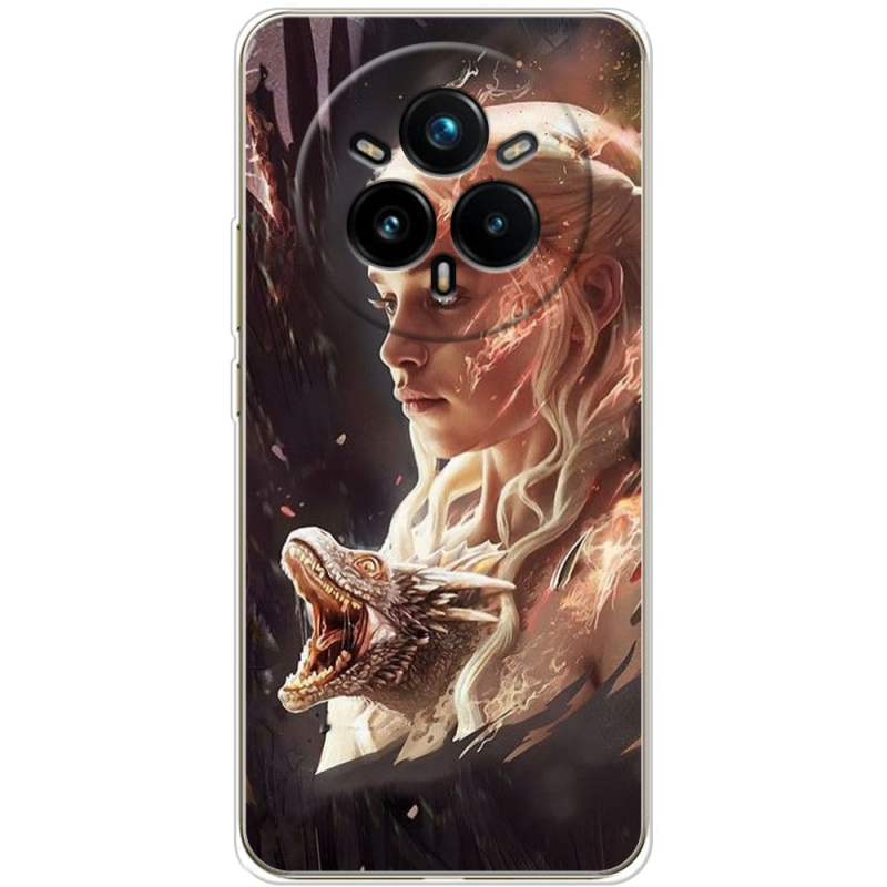 Чохол BoxFace Realme 14 Pro Plus 
