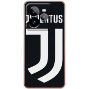 Чохол BoxFace Realme GT 7 Pro FC J