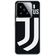 Чохол BoxFace Xiaomi 15 FC J