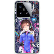 Чохол BoxFace Xiaomi 15 Overwatch D.VA