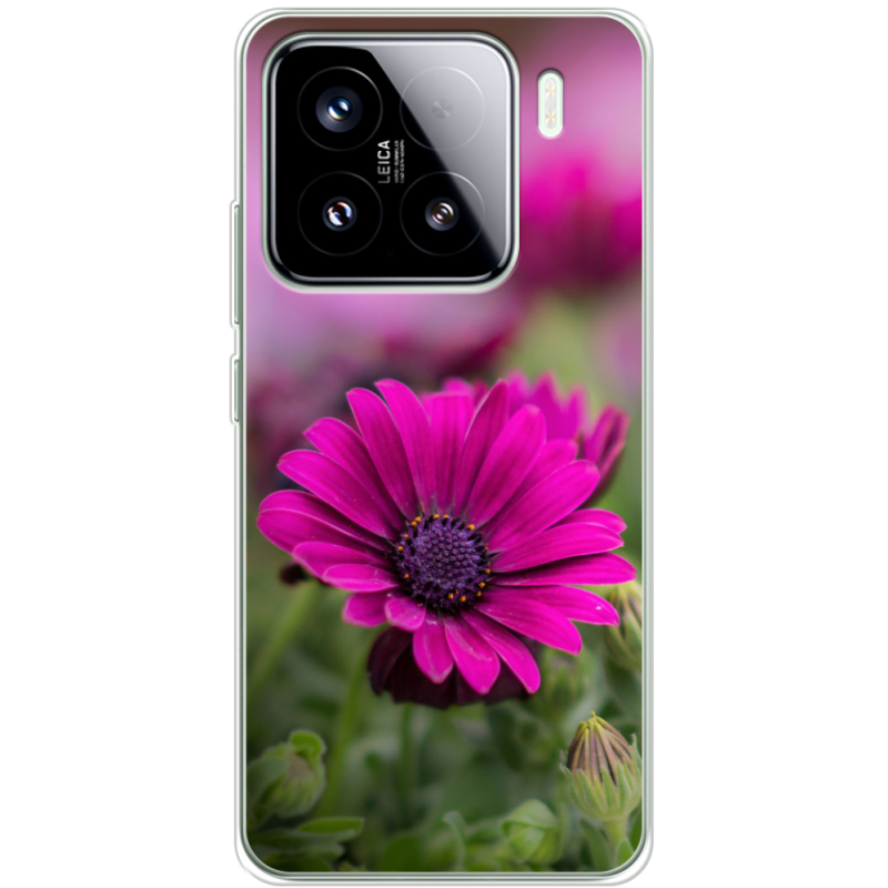 Чохол BoxFace Xiaomi 15 