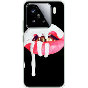 Чохол BoxFace Xiaomi 15 