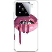 Чохол BoxFace Xiaomi 15 