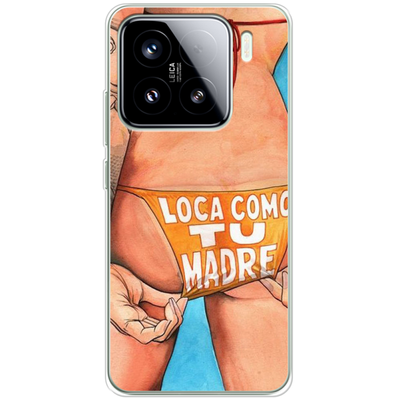 Чохол BoxFace Xiaomi 15 