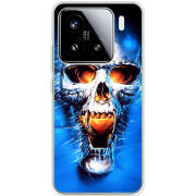 Чохол BoxFace Xiaomi 15 