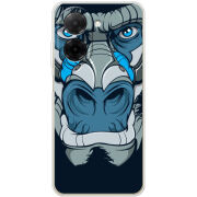 Чохол BoxFace Xiaomi Redmi A5 