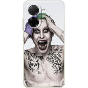 Чохол BoxFace Xiaomi Redmi A5 