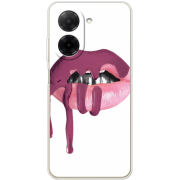 Чохол BoxFace Xiaomi Redmi A5 