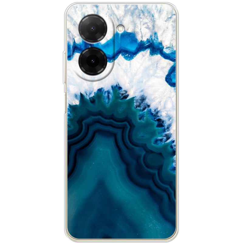 Чохол BoxFace Xiaomi Redmi A5 