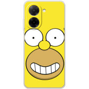 Чохол BoxFace Xiaomi Redmi A5 