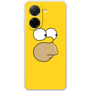 Чохол BoxFace Xiaomi Redmi A5 