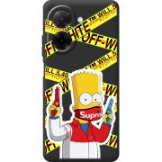 Чорний чохол BoxFace Xiaomi Redmi A5 White Bart