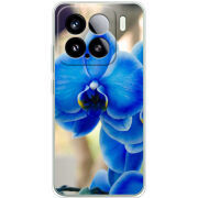 Чохол BoxFace Xiaomi 15 