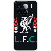 Чохол BoxFace Xiaomi 15 L. F. C.