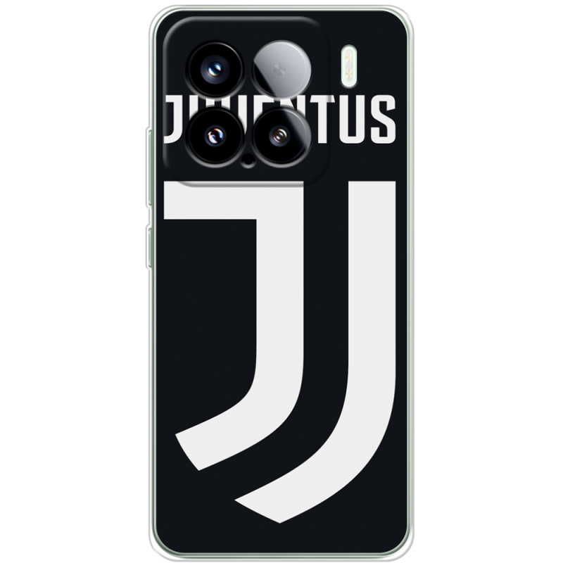 Чохол BoxFace Xiaomi 15 FC J