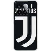 Чохол BoxFace Xiaomi 15 FC J