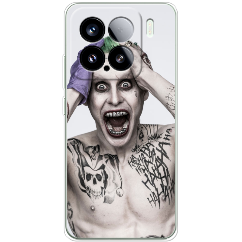 Чохол BoxFace Xiaomi 15 