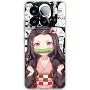 Чохол BoxFace Xiaomi 15 