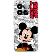 Чохол BoxFace Xiaomi 15 