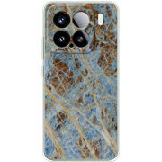 Чохол BoxFace Xiaomi 15 