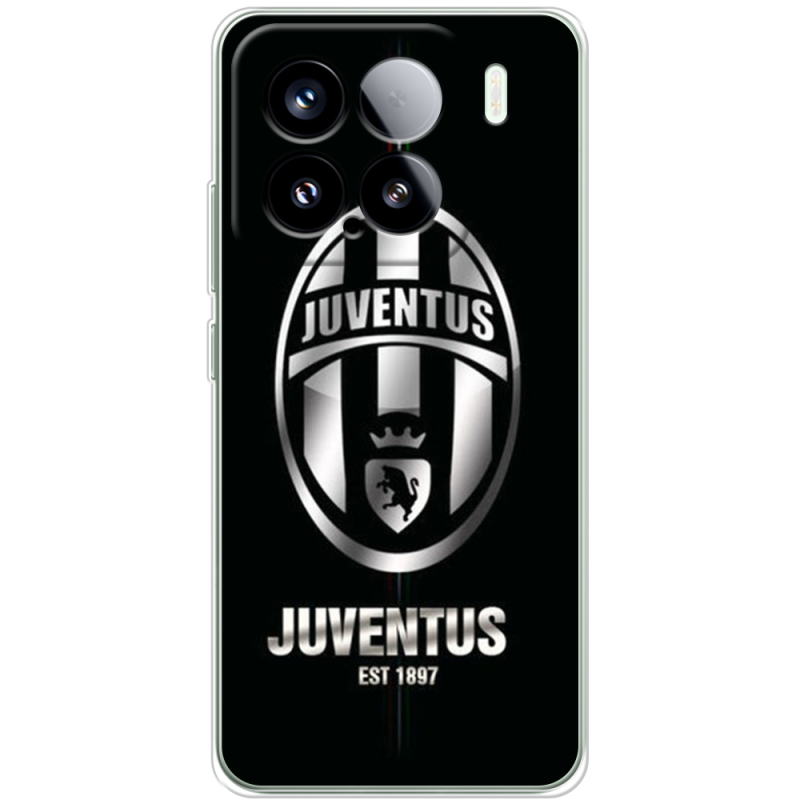 Чохол BoxFace Xiaomi 15 