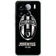 Чохол BoxFace Xiaomi 15 