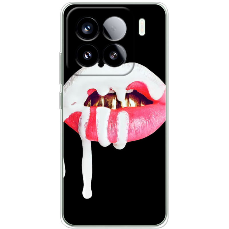 Чохол BoxFace Xiaomi 15 