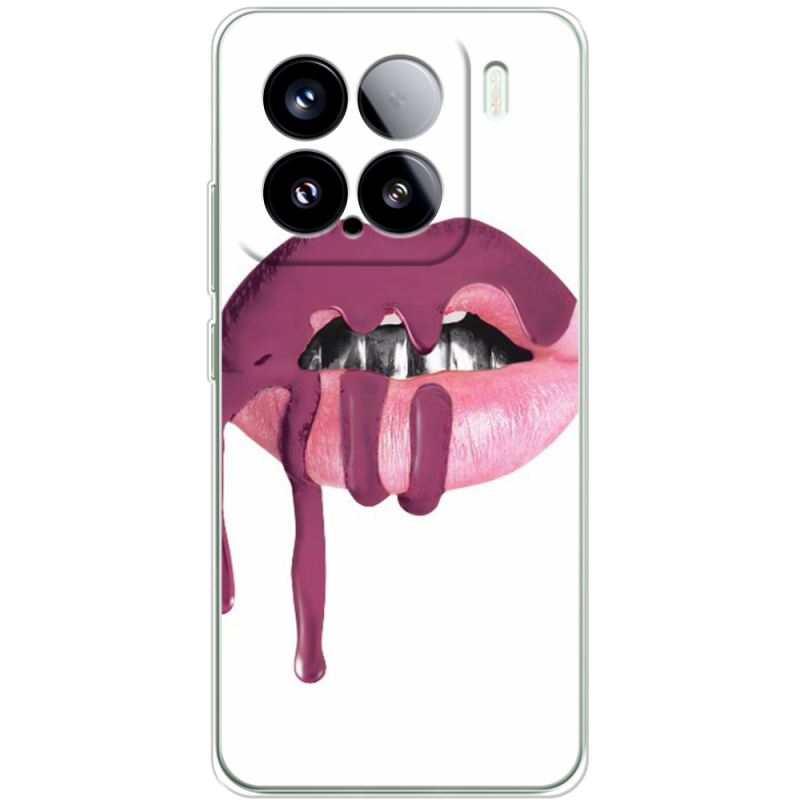 Чохол BoxFace Xiaomi 15 