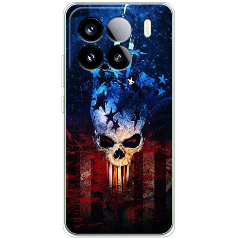 Чохол BoxFace Xiaomi 15 