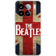 Чохол BoxFace Xiaomi 15 