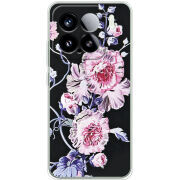 Чохол BoxFace Xiaomi 15 