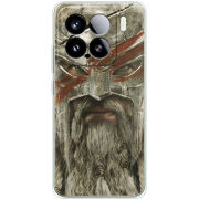 Чохол BoxFace Xiaomi 15 