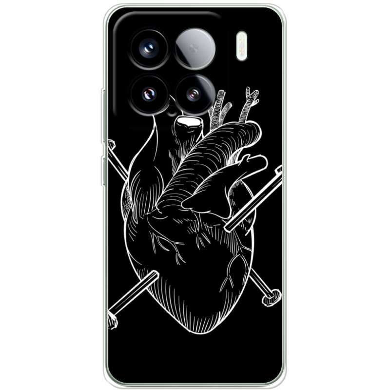 Чохол BoxFace Xiaomi 15 