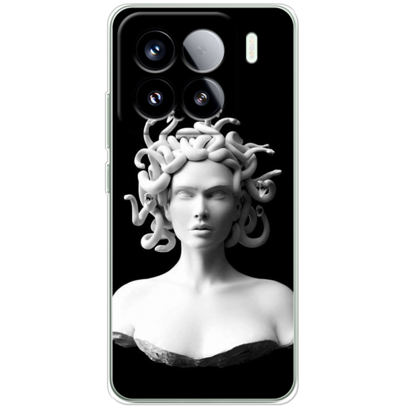 Чохол BoxFace Xiaomi 15 