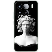 Чохол BoxFace Xiaomi 15 