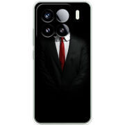 Чохол BoxFace Xiaomi 15 