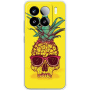 Чохол BoxFace Xiaomi 15 Pineapple Skull