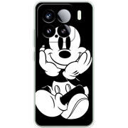 Чохол BoxFace Xiaomi 15 