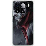 Чохол BoxFace Xiaomi 15 