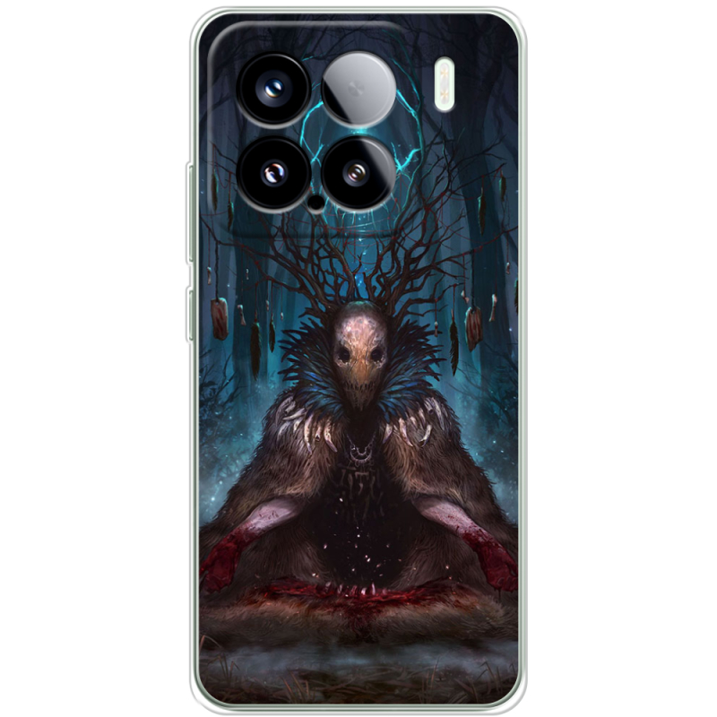 Чохол BoxFace Xiaomi 15 