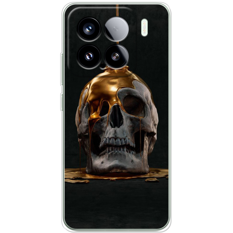 Чохол BoxFace Xiaomi 15 