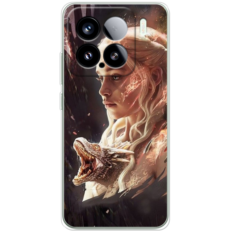 Чохол BoxFace Xiaomi 15 