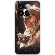 Чохол BoxFace Xiaomi 15 