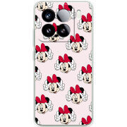 Чохол BoxFace Xiaomi 15 