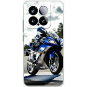 Чохол BoxFace Xiaomi 15 