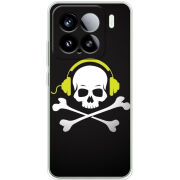 Чохол BoxFace Xiaomi 15 